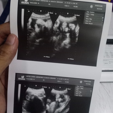 expect the unexpected!