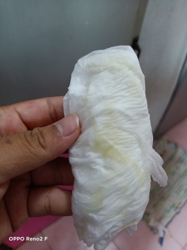 มูกใสสีเหลือง