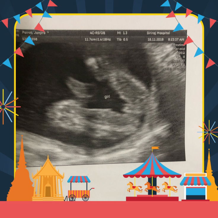 มีโอกาสไหมคะ