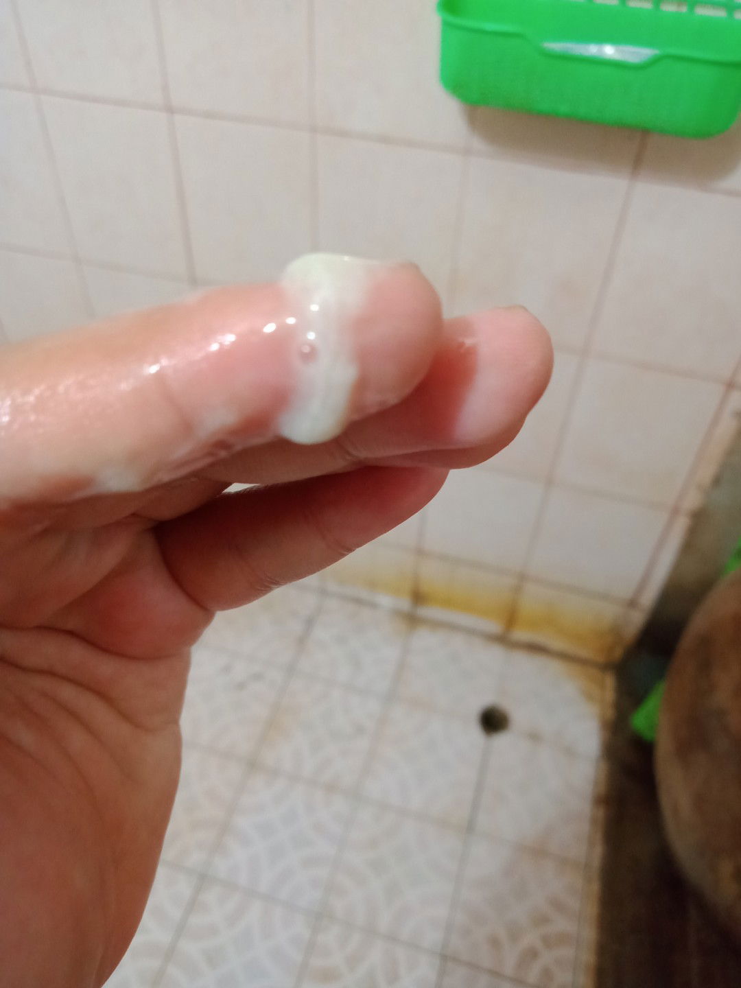 ท้องแรก38+6w