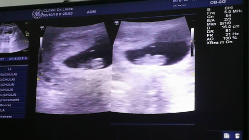 8สัปดาห์แล้วจร้า