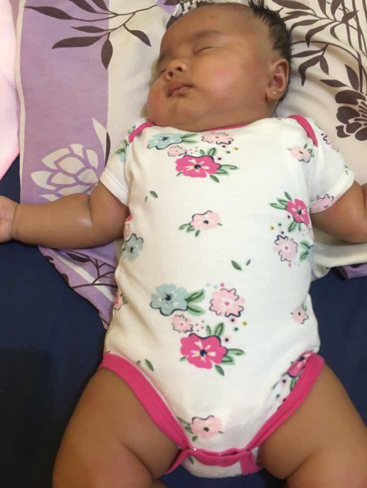 Kulit bayi merah merah