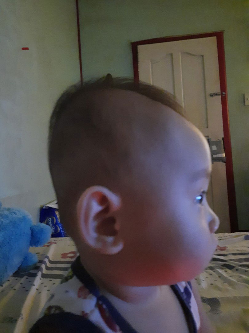 My Baby' Head Shape.