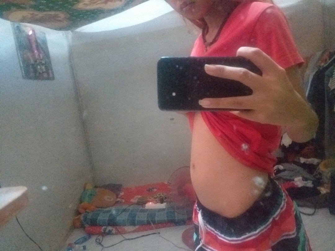 เหมือนคนท้องหรือคนอ้วน