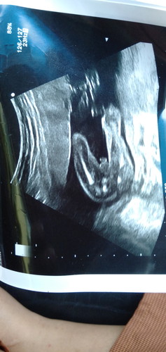 ความรัก