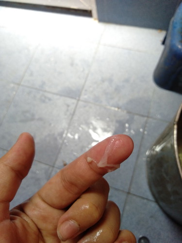 แบบนี้เรียกมูกใสรึป่าว