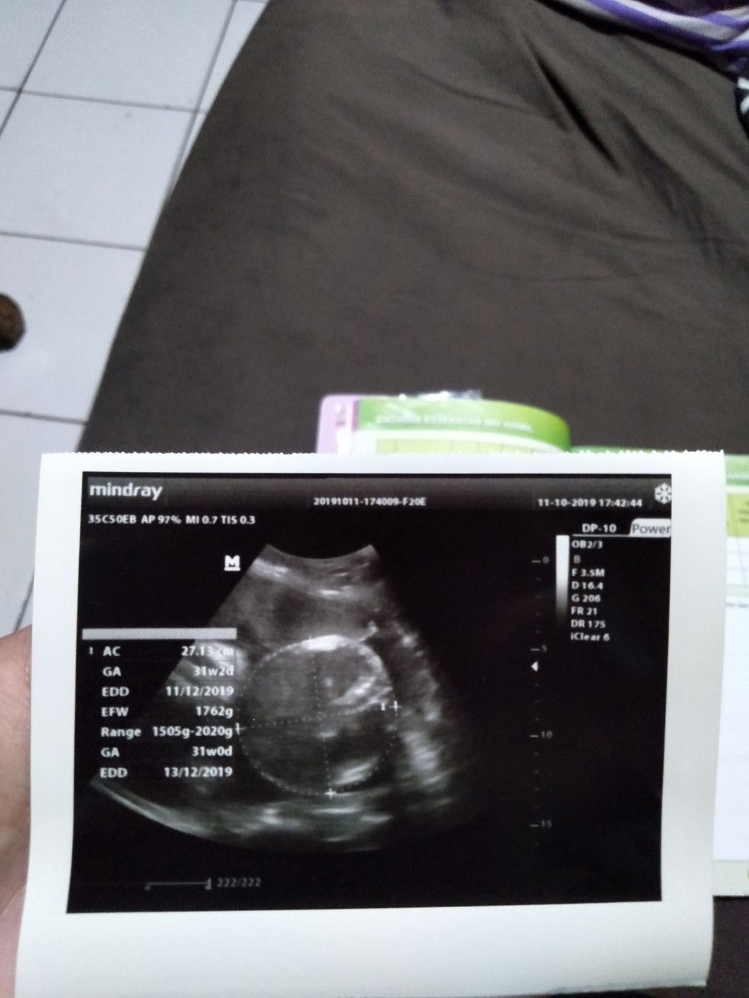 berat dan panjang bayi