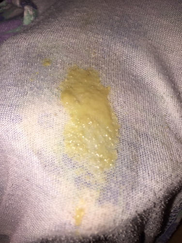Yellow means