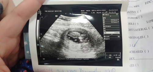 ช่วยตอบเราที