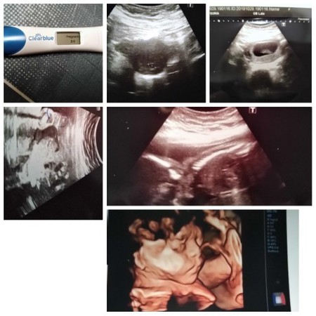 Now 35 Week... ?