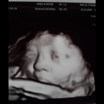 my baby