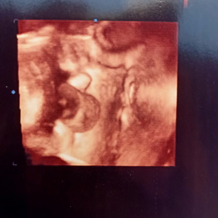 แม่ตื่นเต้น