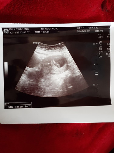 8w2d