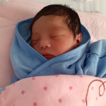 ผ่าตัดคลอด