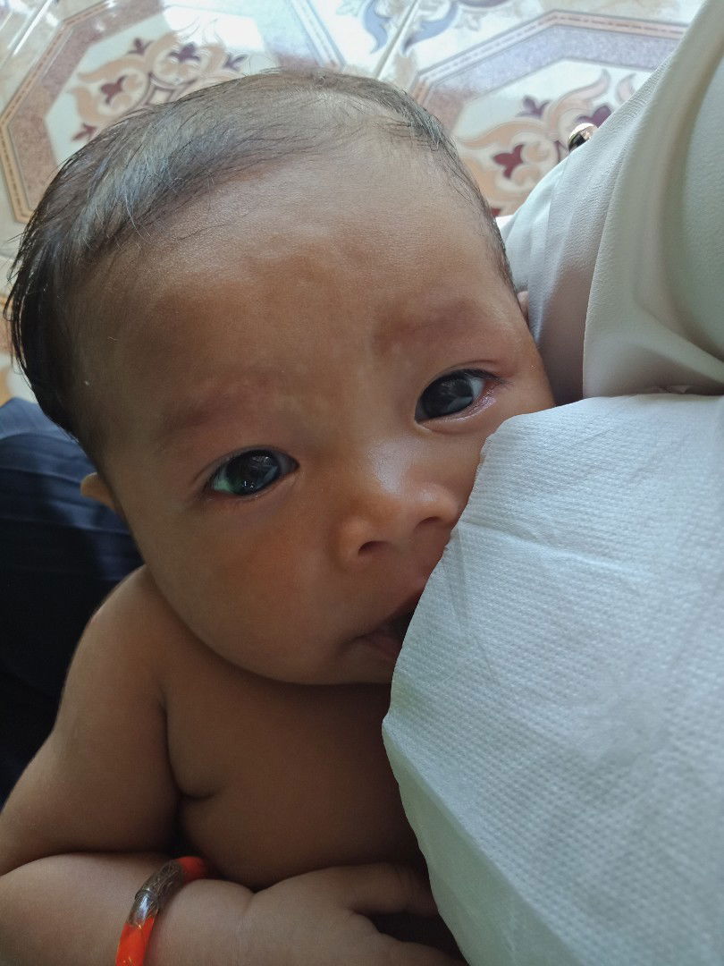 Alergi atau campah asi