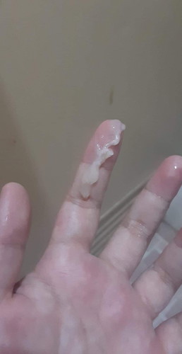 mucus plug