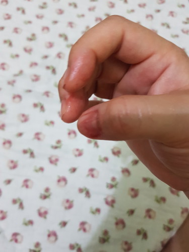 darah slps urutan perineum