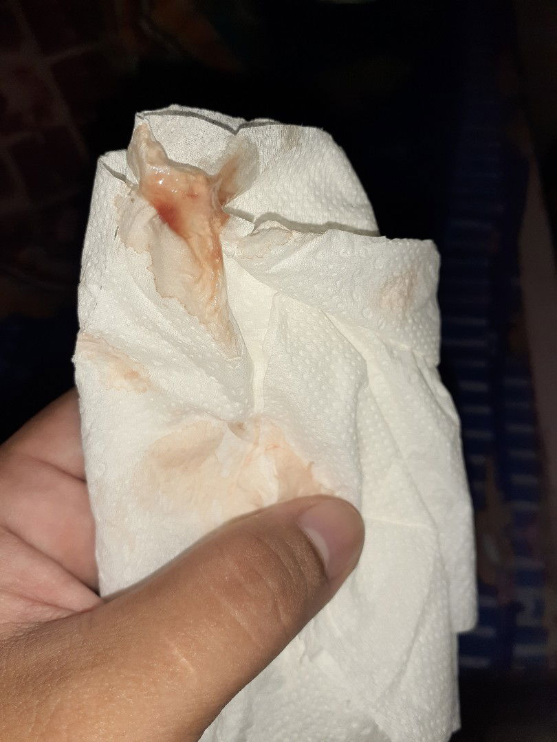 ขอคำแนะนำจากแม่ๆ