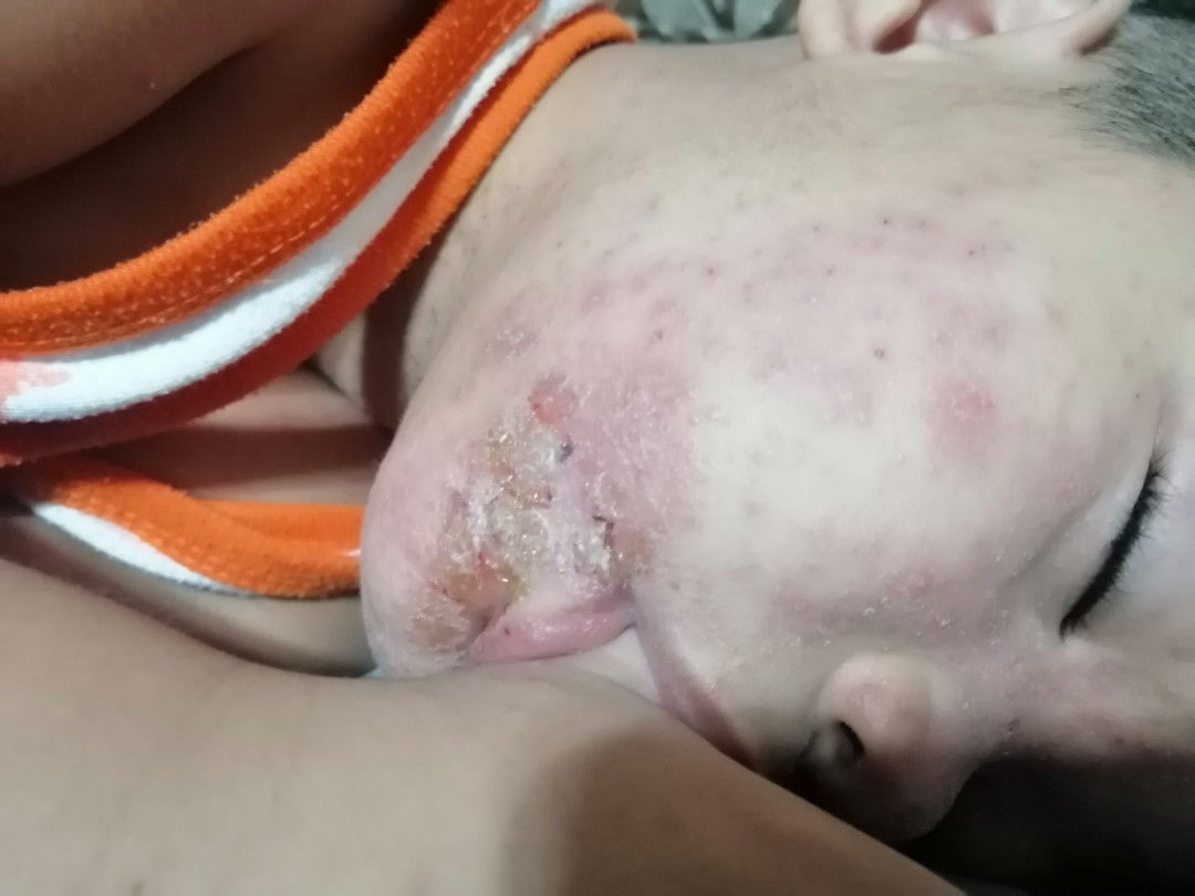 Anong Magandang Cream Sa Mamaso