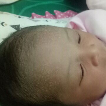 Bintik-bintik putih di kepala