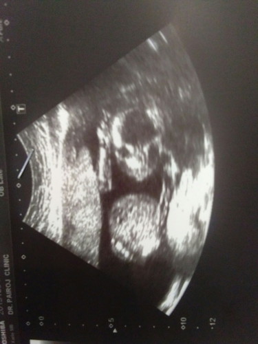 ซาวตอน4เดือน