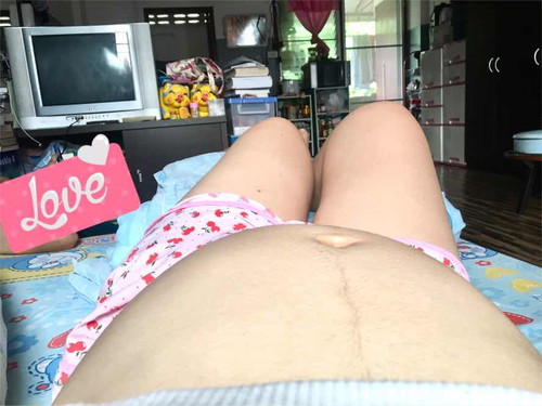 เจ้าแฝด 19 week 4 day❤️❤️