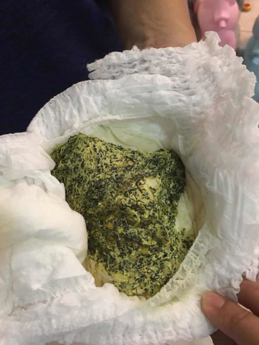 ถ่ายลูก