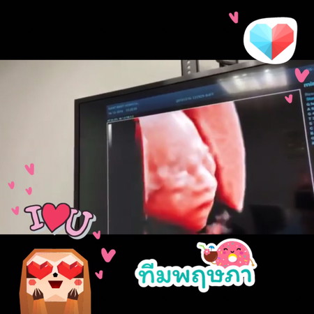 ได้ลูกสาวจ้า