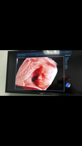 24weeksเอารูปมาอวดกันหน่อยแม่ๆ