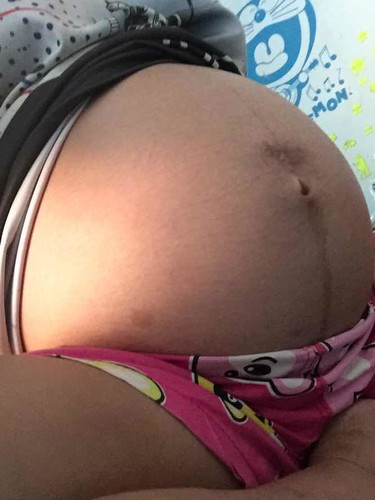 ท้องแรก