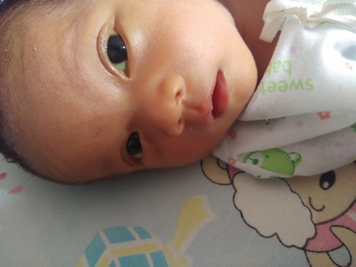 น้องตาเหลือง