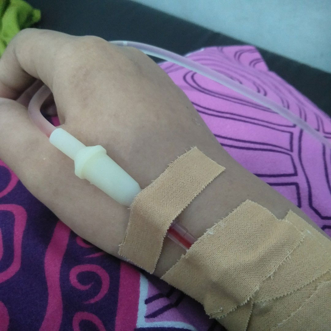 drop di umur janin 38w