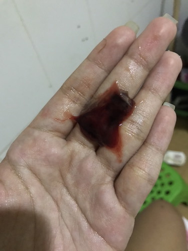 สอบถามค่ะ