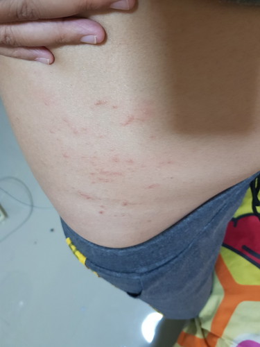 ตุ่ม