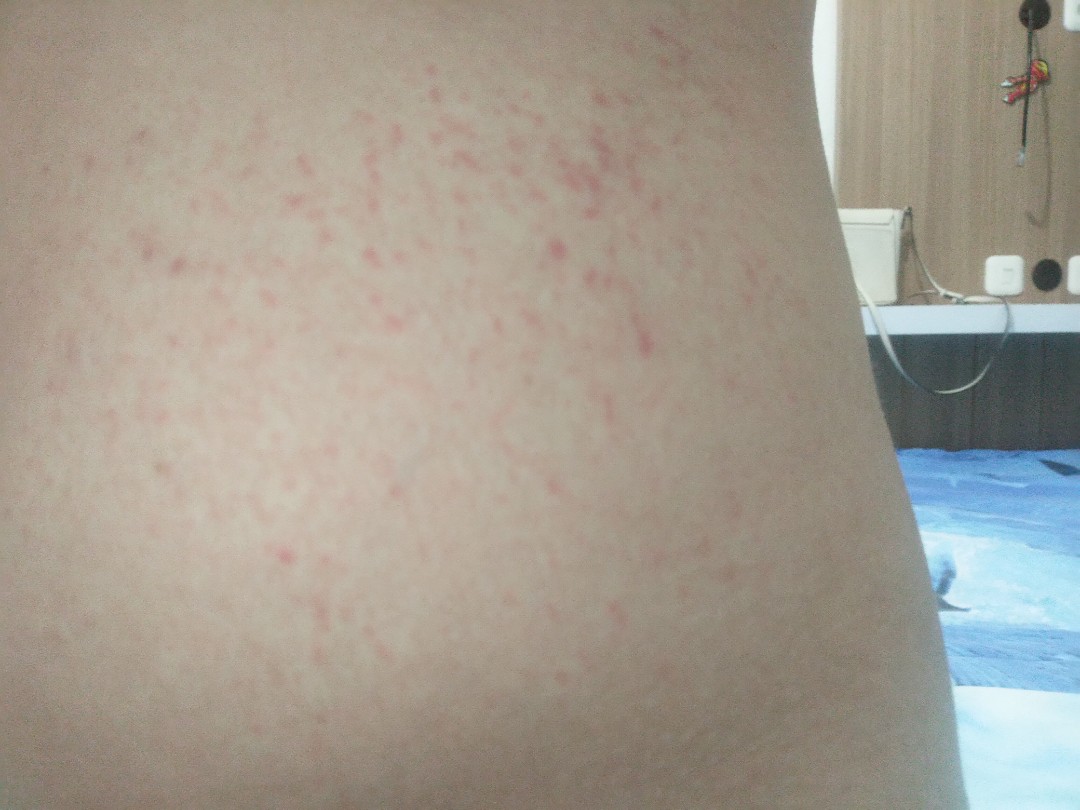mandi pakai detol