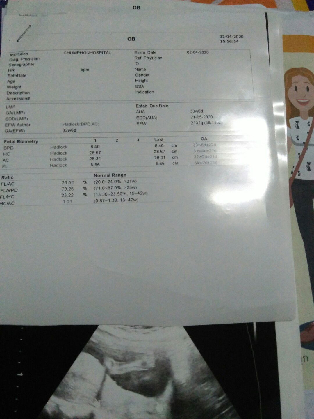 ใบอัลตราซาว์