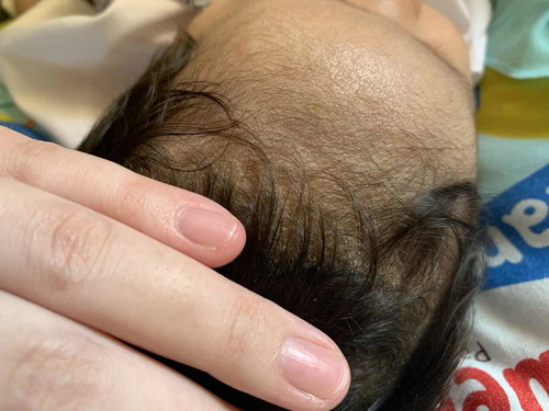 มีลูกบ้านไหนหัวลอกแบบนี้ไหมคะ