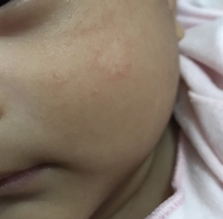 Kulit bayi