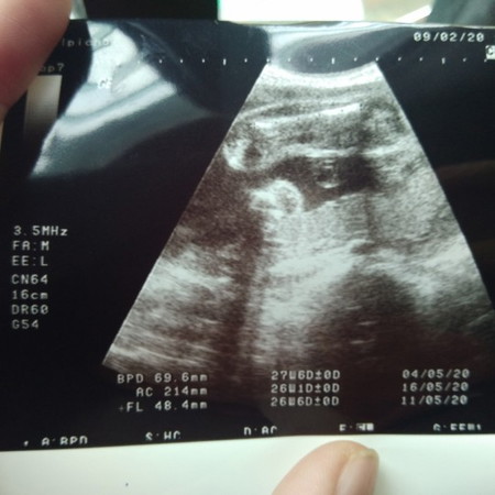 เพศอะไร?