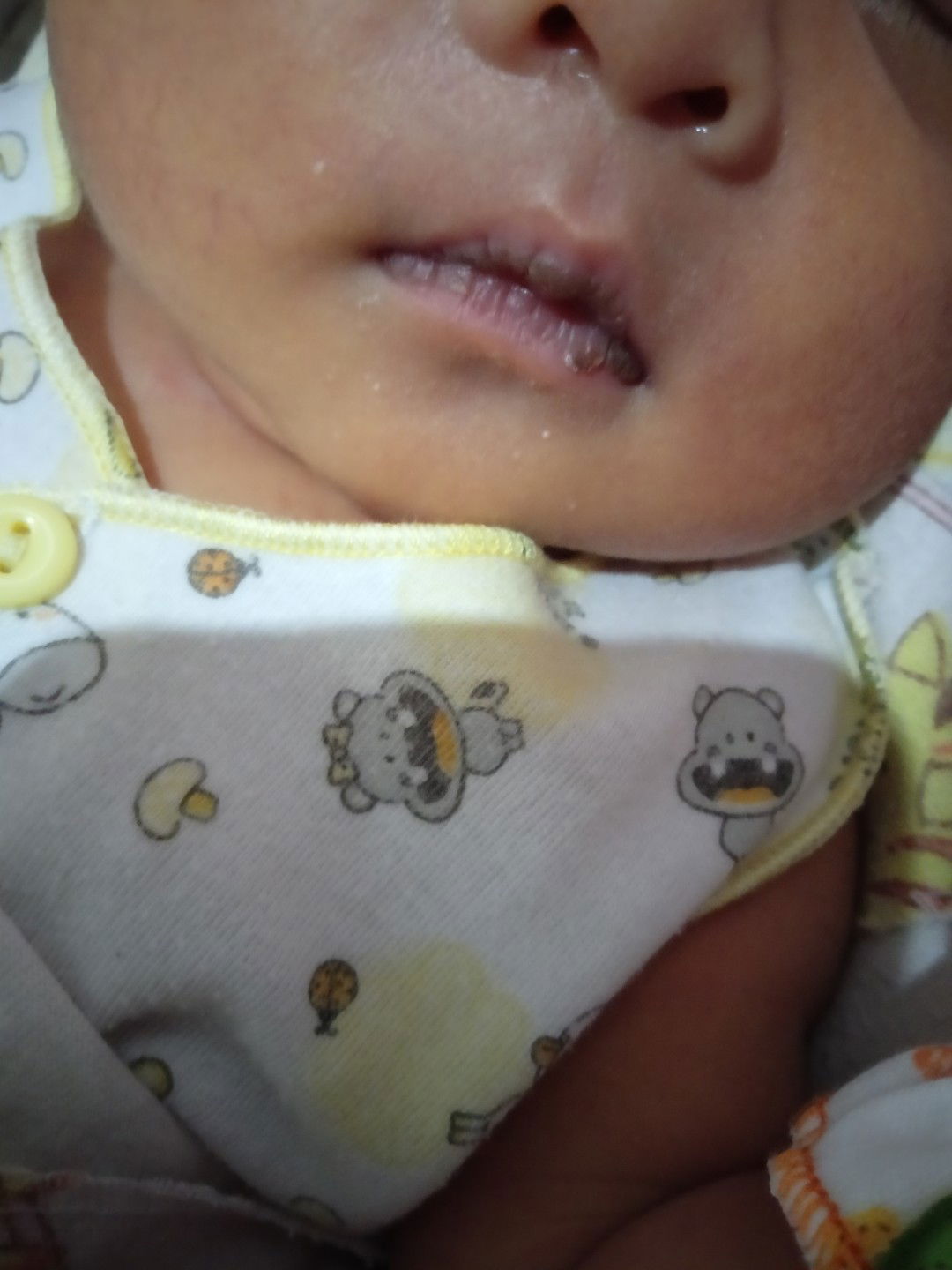 Bibir bayi 5 hari kering + hitam