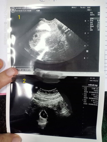 7w without heartbeat