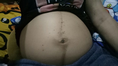 ท้องแรก