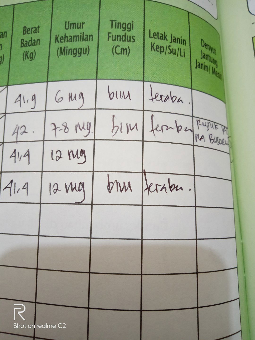Tinggi fundus itu apa ?