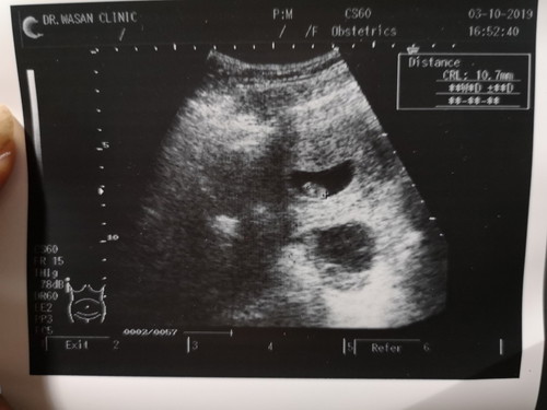 เราไม่มั่นใจวันเป็นประจำเดือนครั้งสุดท้าย