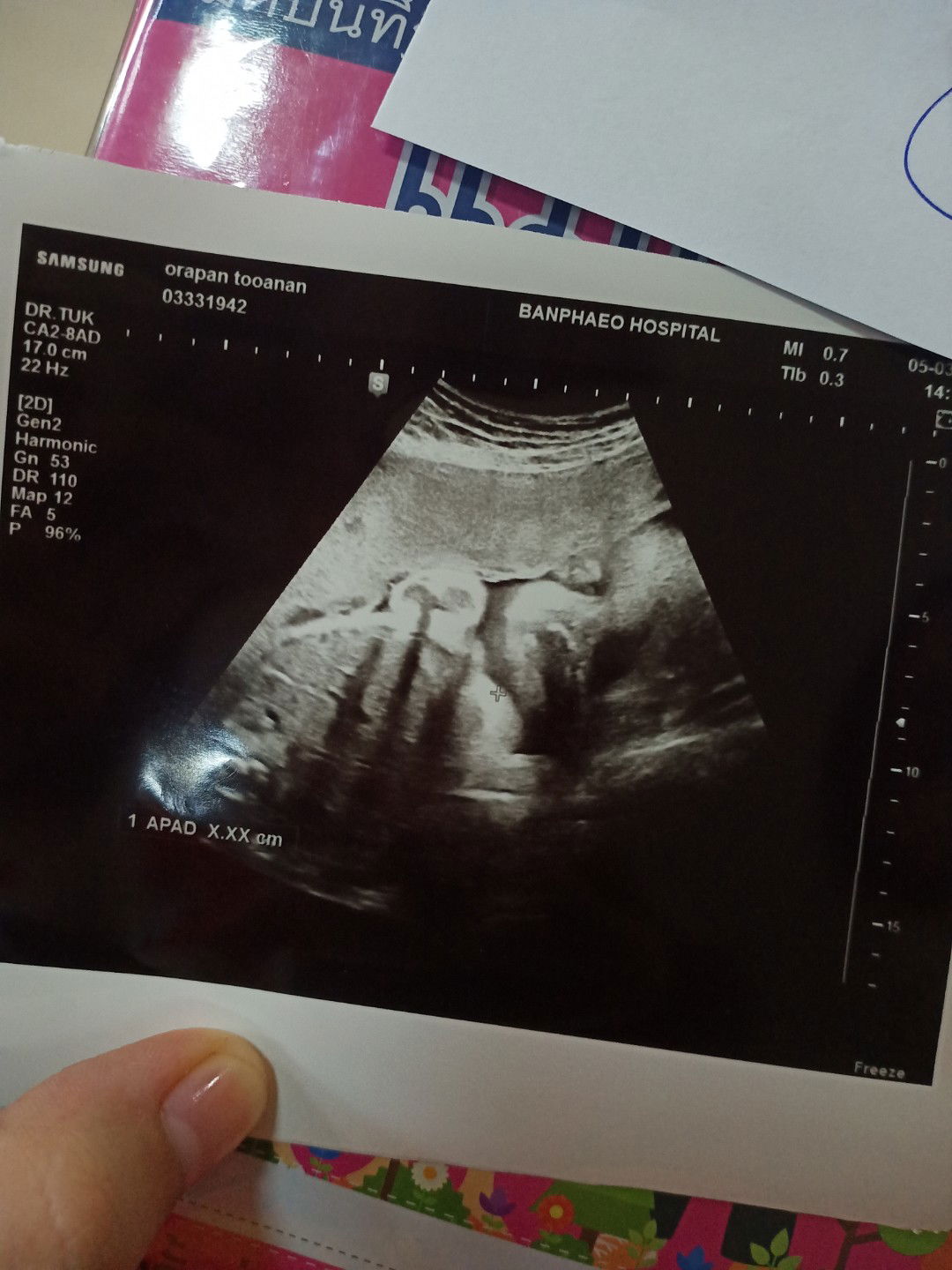 ปวดหน่วงเวลานอนนานนั่งนาน