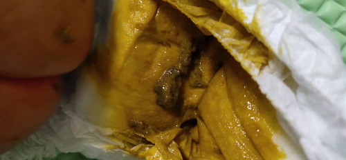 baby's poop