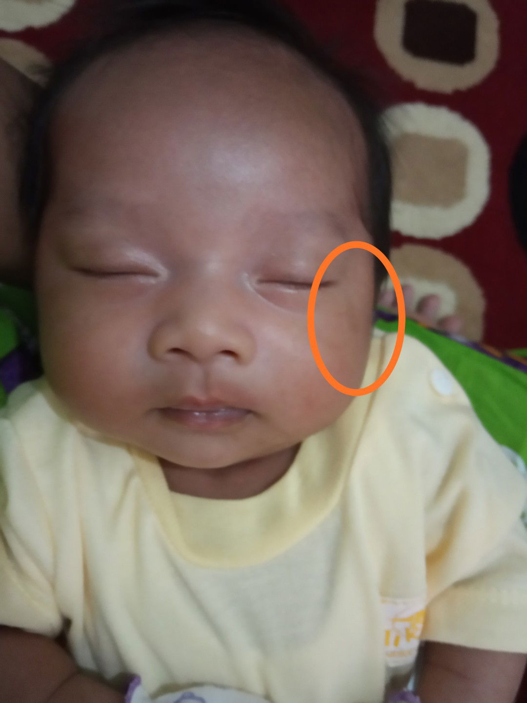 Noda hitam di wajah bayi