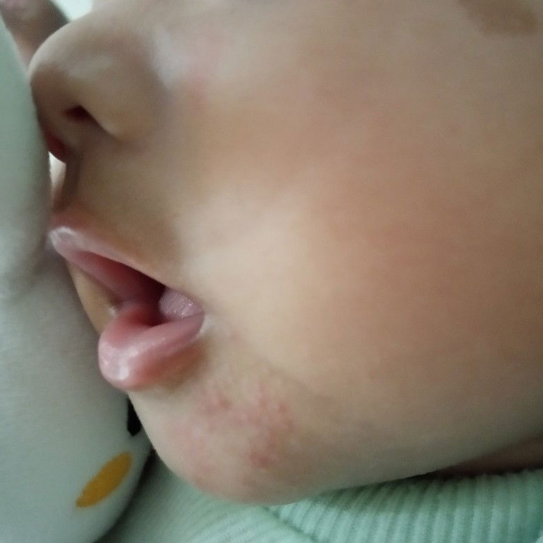 Krim Untuk Kulit Wajah Bayi