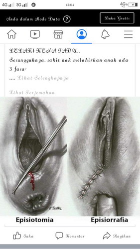 Jahit perenium... MANTUL