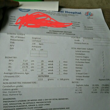 posterior placenta grade 2 high lying????